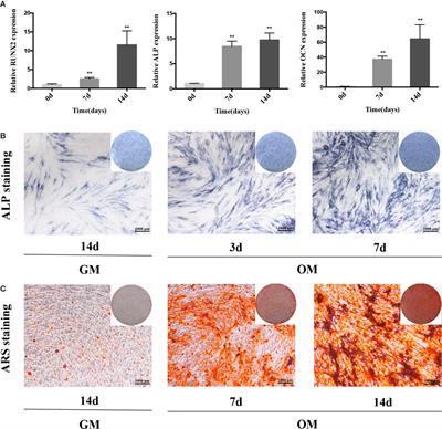 Long Noncoding RNA GAS5 Promotes Osteogenic Differentiation of Human Periodontal Ligament Stem Cells by Regulating GDF5 and p38/JNK Signaling Pathway